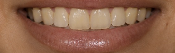 Client result — one session — before