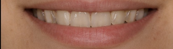 Client result — one session — before