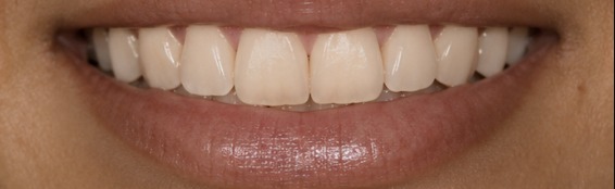 Client result — one session — after one session