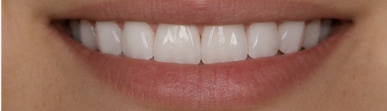 Client result — one session — after one session