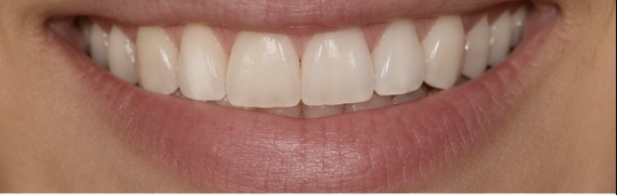 Client result — one session — after one session